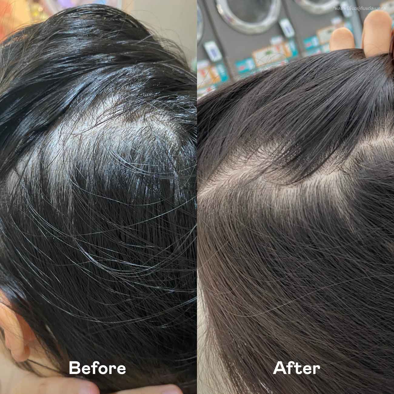Hair Hero Duo Set