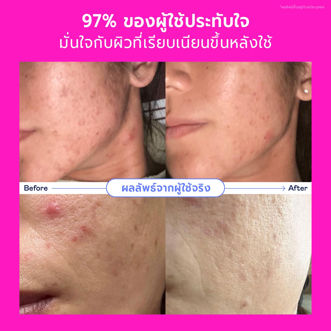 Skincare Promo Set