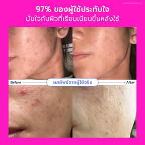 Skincare Promo Set