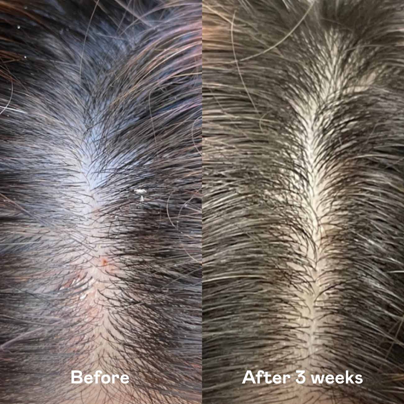 Happy Hair Starter Set