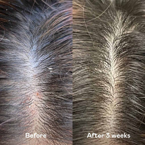 Happy Hair Starter Set